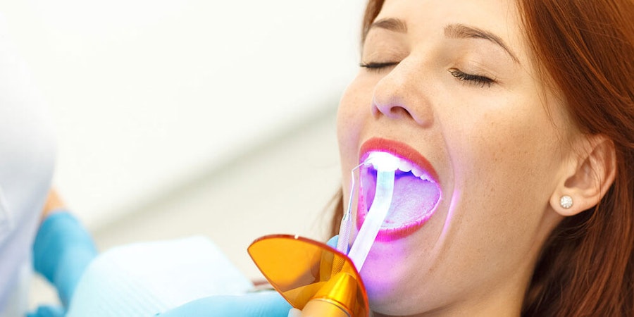 Dental Bonding Medicine Hat